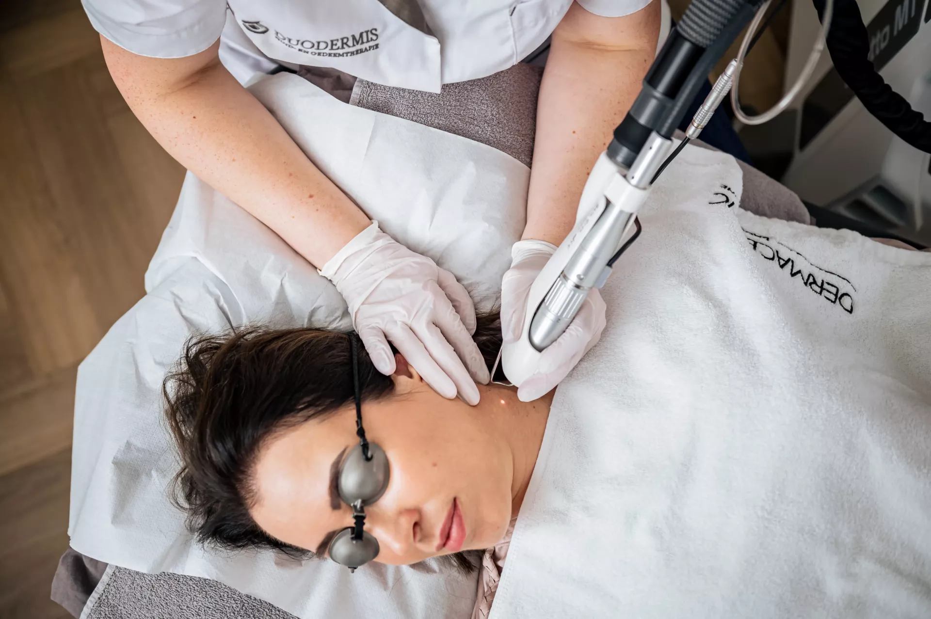 laserbehandeling gezicht