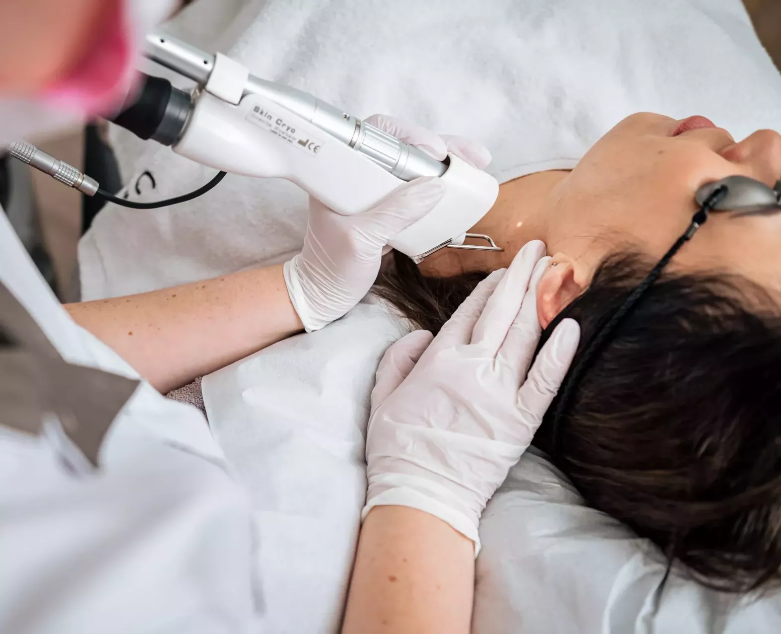 verwijder pigmentvlekken verwijder pigmentvlekken